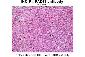Image no. 3 for anti-Peptidyl Arginine Deiminase, Type I (PADI1) antibody (ABIN346989)