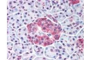 Immunohistochemistry (IHC) image for anti-Wingless-Type MMTV Integration Site Family, Member 10A (WNT10A) (Internal Region) antibody (ABIN2469512)