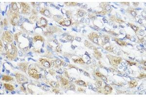 Immunohistochemistry of paraffin-embedded Rat stomach using GPX2 Polyclonal Antibody at dilution of 1:100 (40x lens). (Glutathione Peroxidase 2 Antikörper)