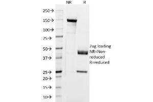SDS-PAGE Analysis Purified Cytokeratin, 5/6/18 Mouse Monoclonal Antibody (LP34). (Keratin 5,6,18 Antikörper)