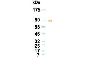 Western Blotting (WB) image for anti-Lactotransferrin (LTF) antibody (ABIN933879)