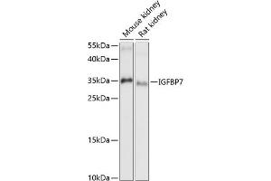 Western blot analysis of extracts of various cell lines, using IGFBP7 antibody (ABIN6131959, ABIN6142263, ABIN6142264 and ABIN6216854) at 1:1000 dilution.
