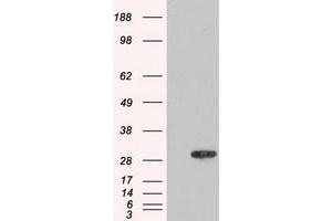 HEK293T cells were transfected with the pCMV6-ENTRY control (Left lane) or pCMV6-ENTRY AK1 (Right lane) cDNA for 48 hrs and lysed. (Adenylate Kinase 1 Antikörper)