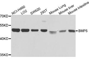 Western blot analysis of extracts of various cells, using BMP5 antibody. (BMP5 Antikörper)
