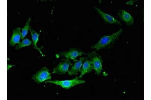 Immunofluorescent analysis of Hela cells using ABIN7167354 at dilution of 1: 100 and Alexa Fluor 488-congugated AffiniPure Goat Anti-Rabbit IgG(H+L) (RAB5 Antikörper  (AA 1-215))
