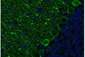 Indirect immunostaining PFA fixed paraffin embedded mouse cerebellum section (dilution 1 : 200; green). (ITPR1 Antikörper)