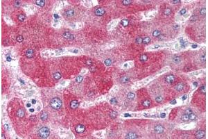 Immunohistochemistry (IHC) image for anti-Wingless-Type MMTV Integration Site Family, Member 1 (WNT1) (Internal Region) antibody (ABIN1049466)