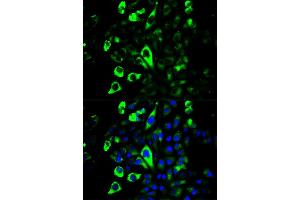 Immunofluorescence analysis of U2OS cells using GZMB antibody (ABIN5971382). (GZMB Antikörper)