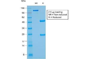 SDS-PAGE Analysis Purified Glycophorin A Mouse Recombinant Monoclonal Ab (rGYPA/280). (Rekombinanter CD235a/GYPA Antikörper)