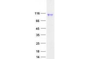 Validation with Western Blot (ECE1 Protein (Transcript Variant 2) (Myc-DYKDDDDK Tag))