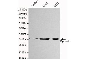 Western blot detection of Cyclin H in Jurkat,K562 and A431 cell lysates using Cyclin H mouse mAb (1:1000 diluted). (Cyclin H Antikörper)