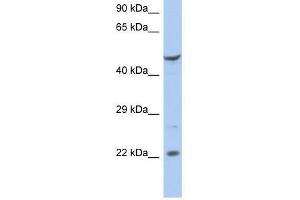 FLJ44894 antibody used at 0. (FLJ44894 Antikörper  (N-Term))