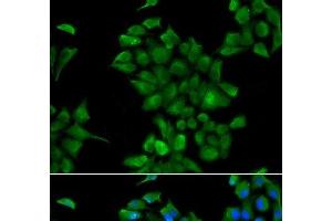 Immunofluorescence analysis of HeLa cells using CTNS Polyclonal Antibody (CTNS Antikörper)