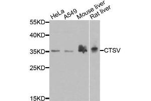 Western blot analysis of extracts of various cell lines, using CTSV antibody. (Cathepsin L2 Antikörper  (AA 105-334))