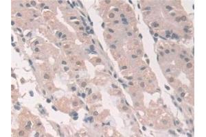 Detection of GCA in Human Stomach Tissue using Polyclonal Antibody to Grancalcin (GCA)