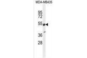 ZNF98 Antibody (C-term) western blot analysis in MDA-MB435 cell line lysates (35 µg/lane). (ZNF98 Antikörper  (C-Term))
