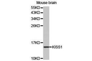 Western Blotting (WB) image for anti-KiSS-1 Metastasis-Suppressor (KISS1) antibody (ABIN1873419) (KISS1 Antikörper)