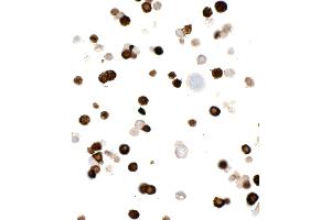 Immunocytochemistry (ICC) image for anti-Myc Tag (AA 410-419) antibody (ABIN7453372) (Rekombinanter Myc Tag Antikörper  (AA 410-419))