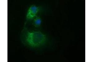 Image no. 3 for anti-Tubulin, beta 2B (TUBB2B) antibody (ABIN1501571) (TUBB2B Antikörper)