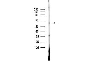 Western blot analysis of lysates from EC304 cells(heat-shock, 45 min treatment), using LINGO2 Antibody at 1/1000 dilution.