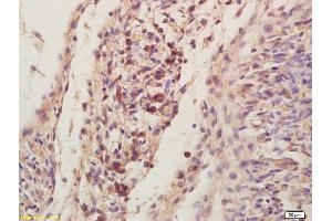 Immunohistochemistry (IHC) image for anti-Platelet-Activating Factor Acetylhydrolase 1b, Regulatory Subunit 1 (45kDa) (PAFAH1B1) (AA 311-410) antibody (ABIN676868)