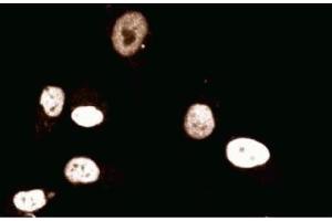 Immunofluorescent staining of Human Endothelial cells. (MCM2 Antikörper  (AA 725-888))