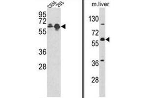 (LEFT) Western blot analysis of MCCC2 Antibody (Center) in CEM, 293 cell line lysates (35ug/lane). (MCCC2 Antikörper  (Middle Region))