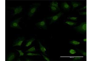Immunofluorescence of purified MaxPab antibody to PSMB7 on HeLa cell. (PSMB7 Antikörper  (AA 1-277))