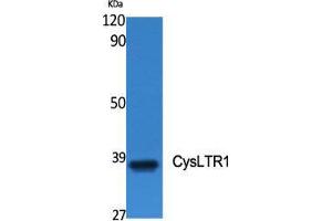 Western Blot (WB) analysis of specific cells using CysLTR1 Polyclonal Antibody.