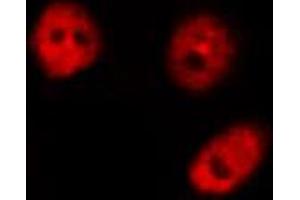 Immunofluorescence (fixed cells) (IF/ICC) image for anti-Nuclear Factor of kappa Light Polypeptide Gene Enhancer in B-Cells 1 (NFKB1) (pSer907) antibody (ABIN6255562)