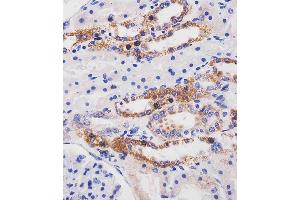 (ABIN6244111 and ABIN6577256) staining ME2 in human kidney tissue sections by Immunohistochemistry (IHC-P - paraformaldehyde-fixed, paraffin-embedded sections). (NAD-ME Antikörper  (C-Term))
