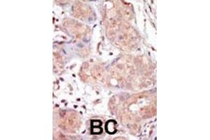 Immunohistochemistry (IHC) image for anti-Male Germ Cell-Associated Kinase (MAK) antibody (ABIN3003276)