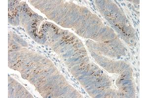 Image no. 1 for anti-Growth Regulated Oncogene gamma (GRO gamma) antibody (ABIN465908) (GRO gamma Antikörper)