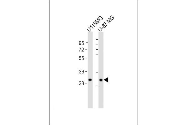 Syntaxin 1B Antikörper  (AA 150-183)