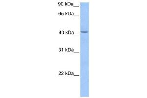 HMBS antibody used at 1 ug/ml to detect target protein. (HMBS Antikörper  (Middle Region))