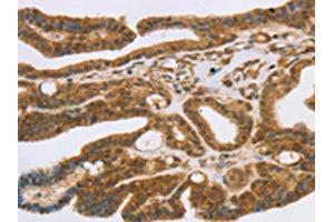 Immunohistochemistry (IHC) image for anti-Solute Carrier Family 7 (Cationic Amino Acid Transporter, Y+ System), Member 9 (SLC7A9) antibody (ABIN7192525)
