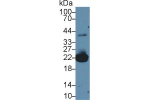 Western Blot; Sample: Mouse Liver lysate; Primary Ab: 2µg/ml Rabbit Anti-Mouse PRDX1 Antibody Second Ab: 0. (Peroxiredoxin 1 Antikörper  (AA 1-199))