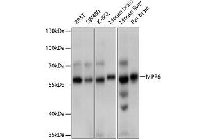 Western blot analysis of extracts of various cell lines, using MPP6 antibody (ABIN6132328, ABIN6143972, ABIN6143973 and ABIN6214790) at 1:1000 dilution. (MPP6 Antikörper  (AA 220-420))