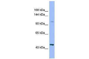 XYLT2 antibody used at 1 ug/ml to detect target protein.