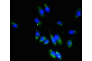 Immunofluorescent analysis of Hela cells using ABIN7171842 at dilution of 1:100 and Alexa Fluor 488-congugated AffiniPure Goat Anti-Rabbit IgG(H+L) (TSPAN1 Antikörper  (AA 110-211))