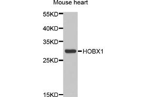 Western blot analysis of extracts of mouse heart, using HOXB1 antibody (ABIN5973981) at 1/1000 dilution. (HOXB1 Antikörper)