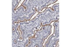 Immunohistochemical staining of human duodenum with MYO7B polyclonal antibody  shows strong membranous positivity in glandular cells at 1:20-1:50 dilution. (Myosin VIIB Antikörper)
