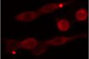 ABIN6274280 staining Hela cells by IF/ICC.