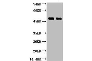 Western blot analysis of 1) Hela, 2) 293T, diluted at 1:3000.