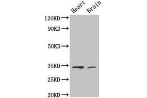 Western Blot Positive WB detected in: Mouse heart tissue, Mouse brain tissue All lanes: CDK5 antibody at 4 μg/mL Secondary Goat polyclonal to rabbit IgG at 1/50000 dilution Predicted band size: 34, 30 kDa Observed band size: 34 kDa (CDK5 Antikörper  (AA 1-292))