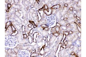IHC testing of FFPE rat kidney tissue with GAD65 antibody at 1ug/ml.