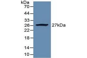 Detection of Recombinant EZH2, Human using Polyclonal Antibody to Enhancer Of Zeste Homolog 2 (EZH2) (EZH2 Antikörper  (AA 51-285))