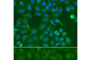 Immunofluorescence analysis of A549 cells using SSX5 Polyclonal Antibody (SSX5 Antikörper)