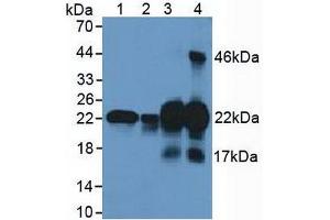 Figure. (CSRP1 Antikörper  (AA 1-193))
