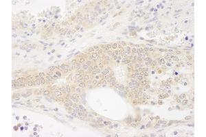 Immunohistochemistry (IHC) image for anti-DEAD (Asp-Glu-Ala-As) Box Polypeptide 19B (DDX19B) (C-Term) antibody (ABIN7448514)